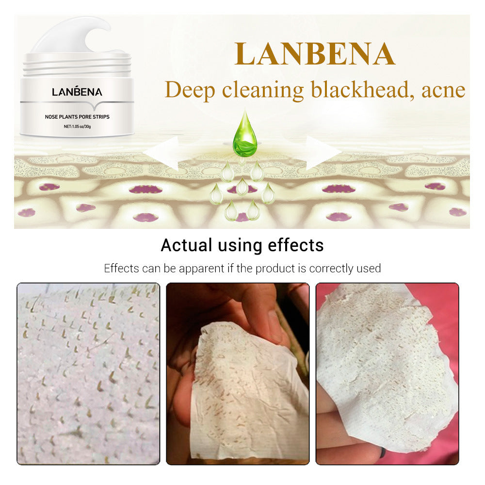 Blackhead Nasal Membrane Sucking Blackhead Tearing To Remove Acne - KuzuSHOP