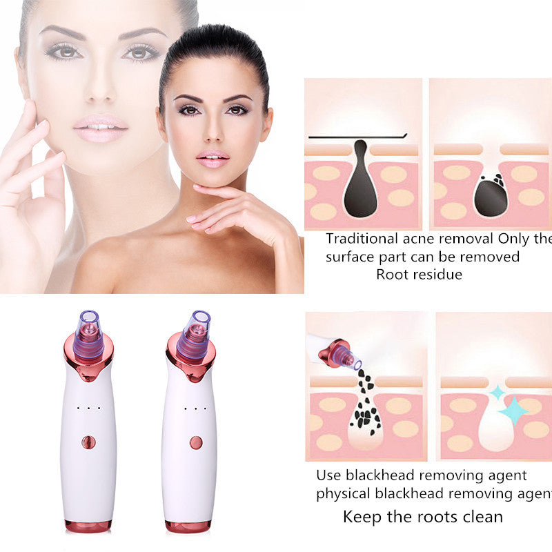 Blackhead Remover Instrument Black Dot Remover Acne Vacuum Suction Face Clean Black Head Pore Cleaning Beauty Skin Care Tool - KuzuSHOP