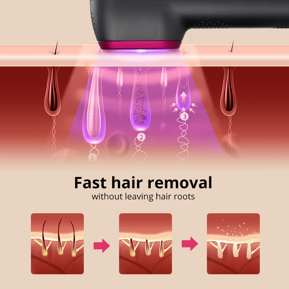 1PCS Laser Hair Removal For Women And Man 100,000 Flashes IPL Painless Laser Hair Removal - KuzuSHOP