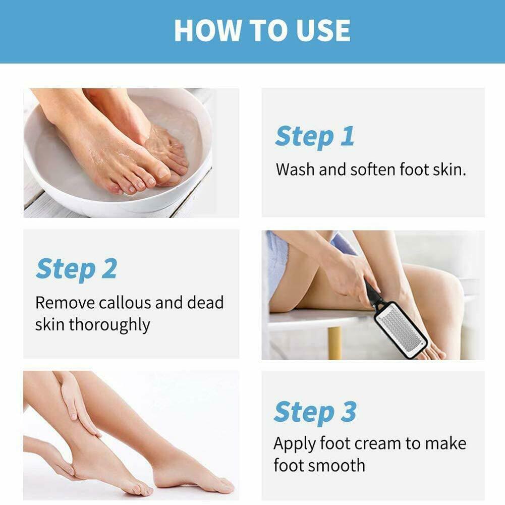 Professional Foot Callus Remover File Rasp Scraper Cracked Pedicure Rough Tool - KuzuSHOP