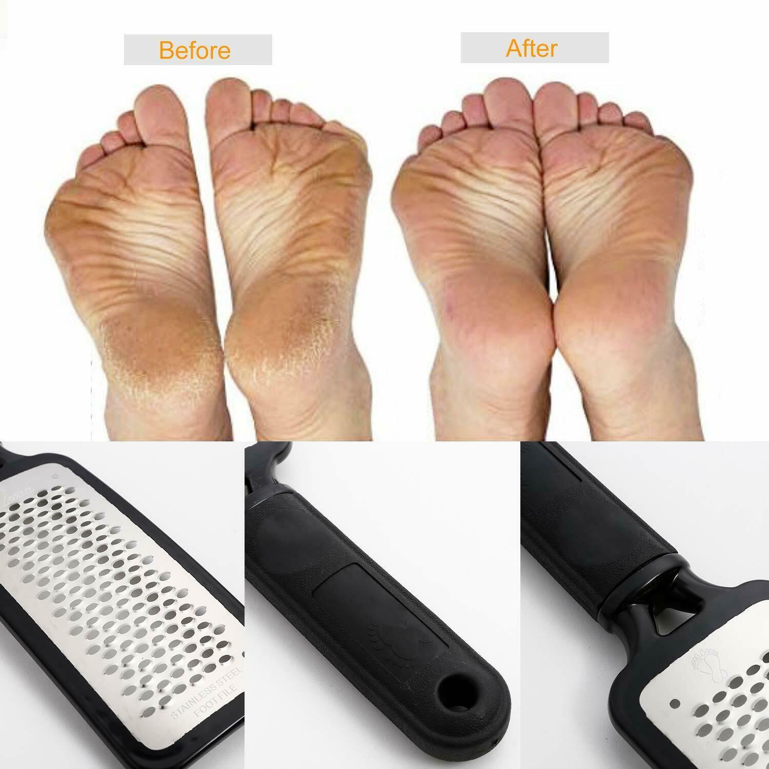 Professional Foot Callus Remover File Rasp Scraper Cracked Pedicure Rough Tool - KuzuSHOP