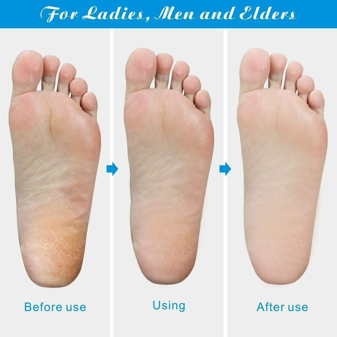 Professional Foot Callus Remover File Rasp Scraper Cracked Pedicure Rough Tool - KuzuSHOP