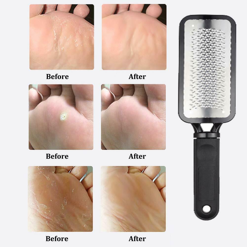 Professional Foot Callus Remover File Rasp Scraper Cracked Pedicure Rough Tool - KuzuSHOP